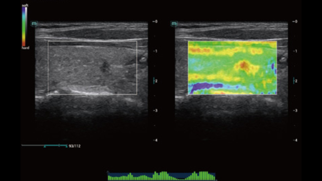 Ecógrafo Consona N7 – imagen 1