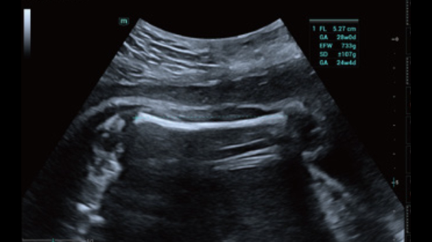 Ecógrafo Consona N7 – imagen 3