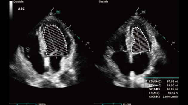 Ecógrafo Consona N7 – imagen 4